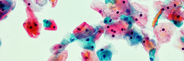 Collection: Cervical Cancer Awareness Month