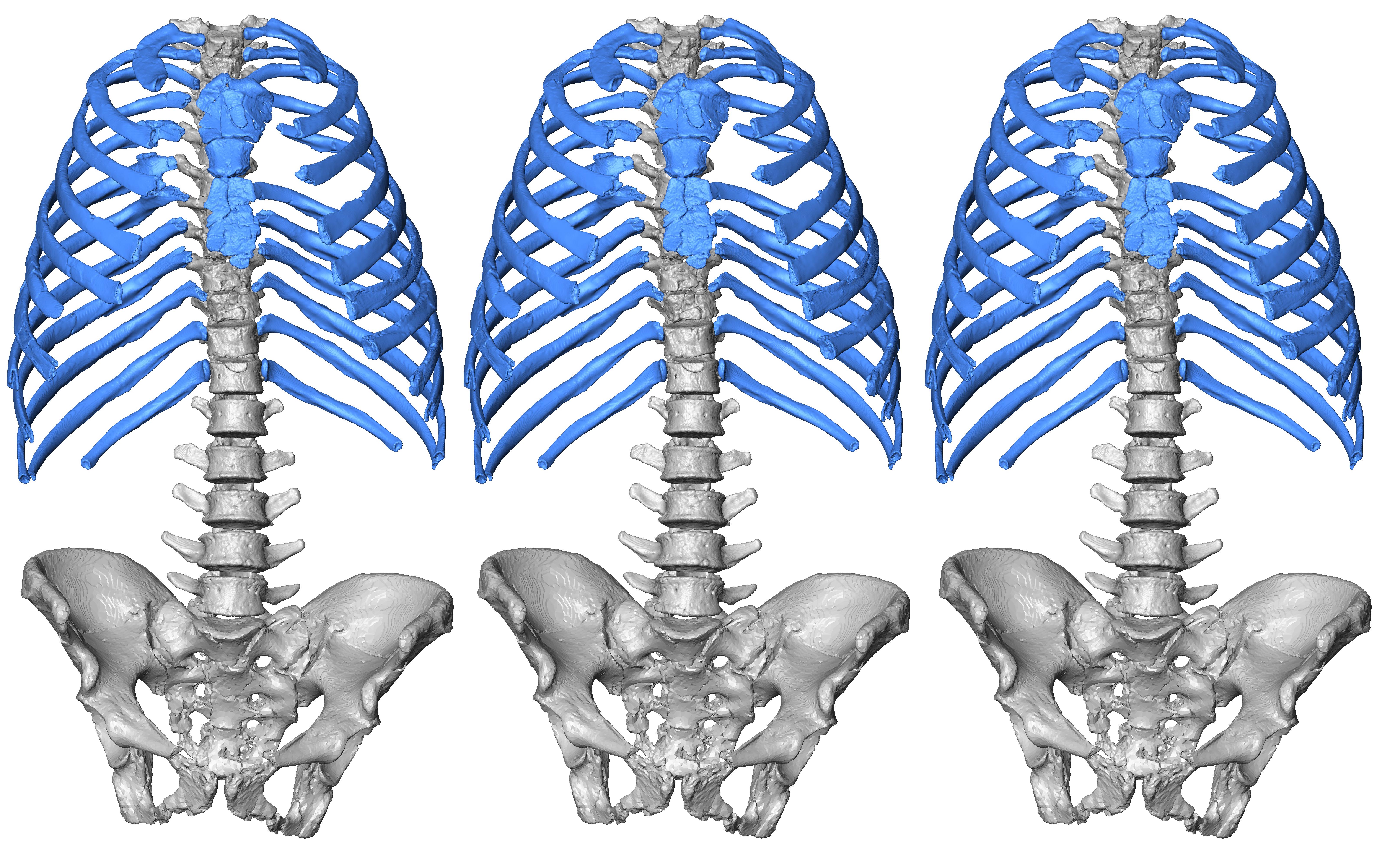 Step by step, rib by rib: how we virtually reconstructed a Neandertal thorax