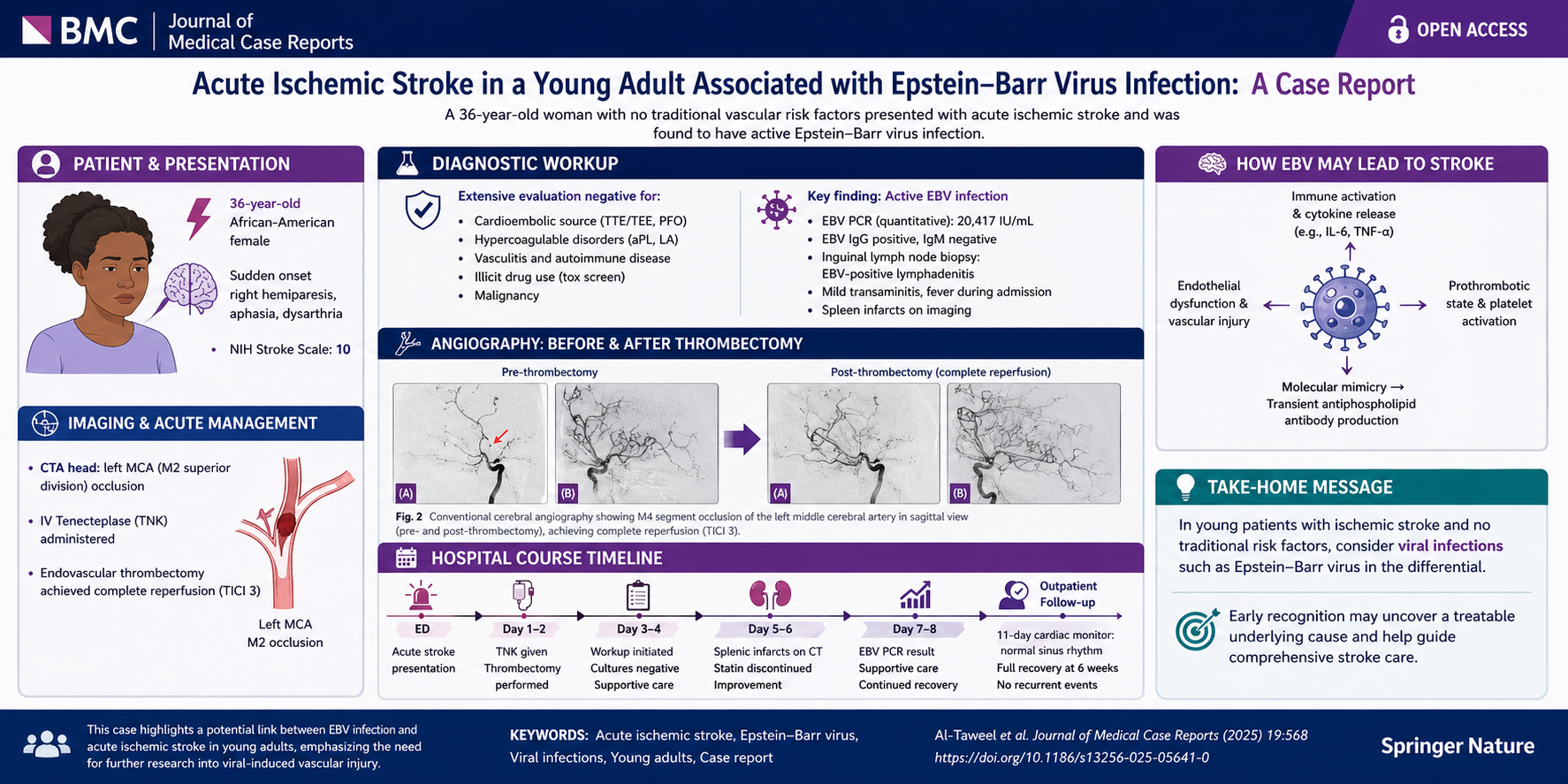 When Infection Triggers Stroke: Epstein–Barr Virus in a Young Adult with Acute Ischemic Stroke