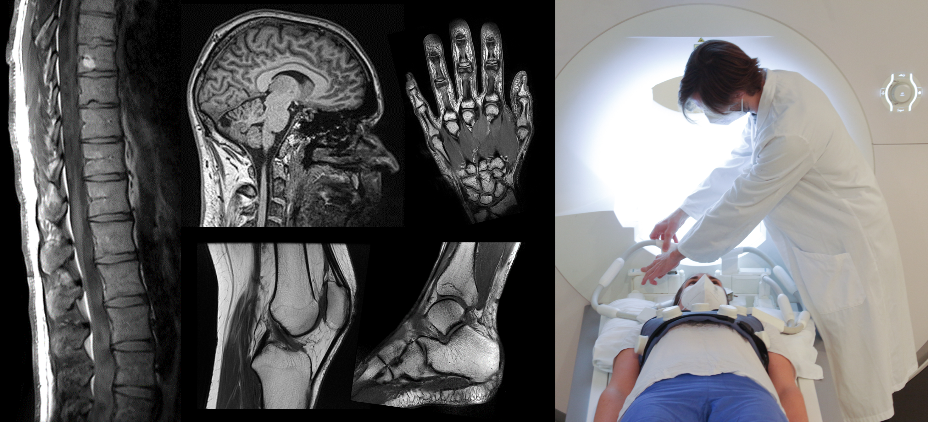 Citizen science approach to assessing patient perception of MRI