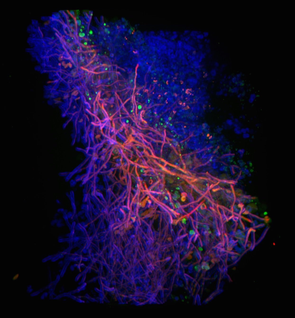 Fungal “looks” can take your breath away
