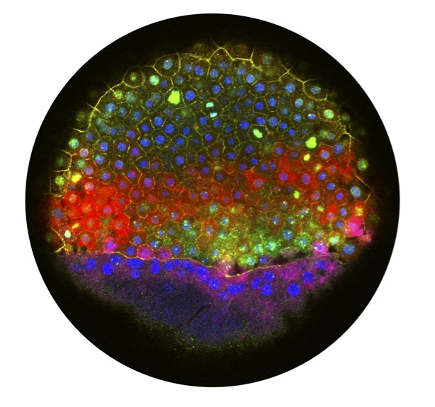 Spatial reconstruction of single-cell gene expression data.