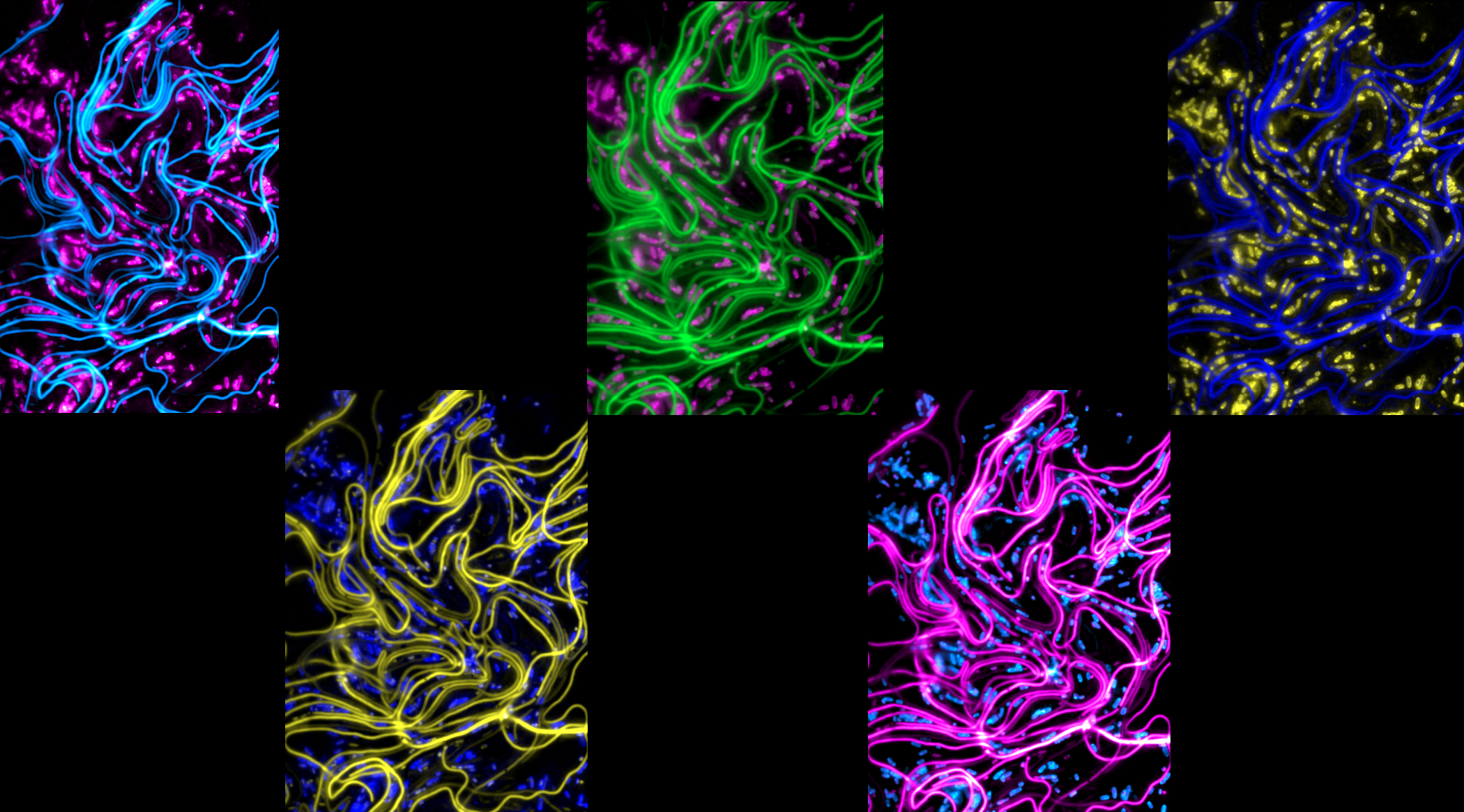 Understanding infection-related filamentation and reversal of Uropathogenic E. coli