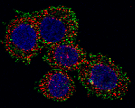 How a RAS inhibitor conspires with death to  protect tumours