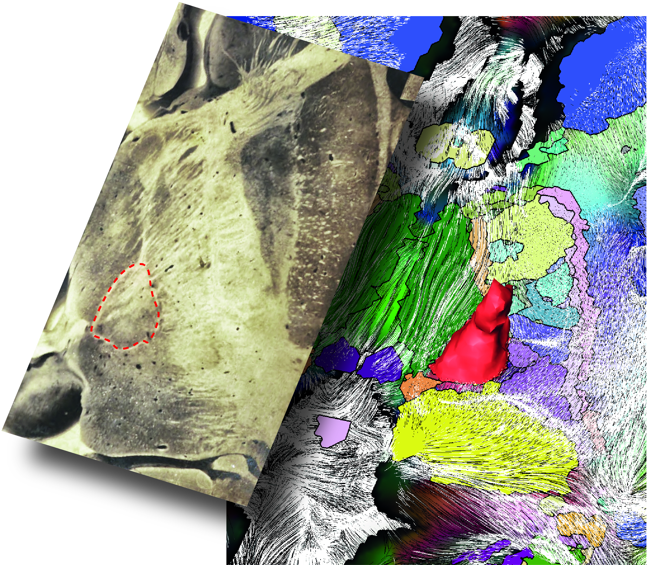 An update on the architecture of the human deep brain