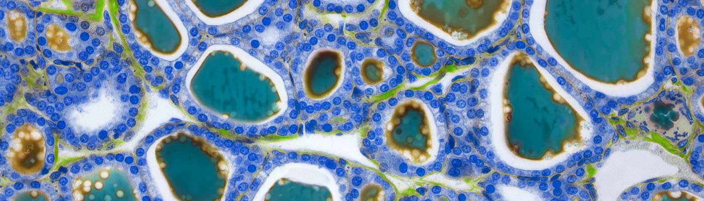 Top 100 Scientific Reports microbiology papers from 2017