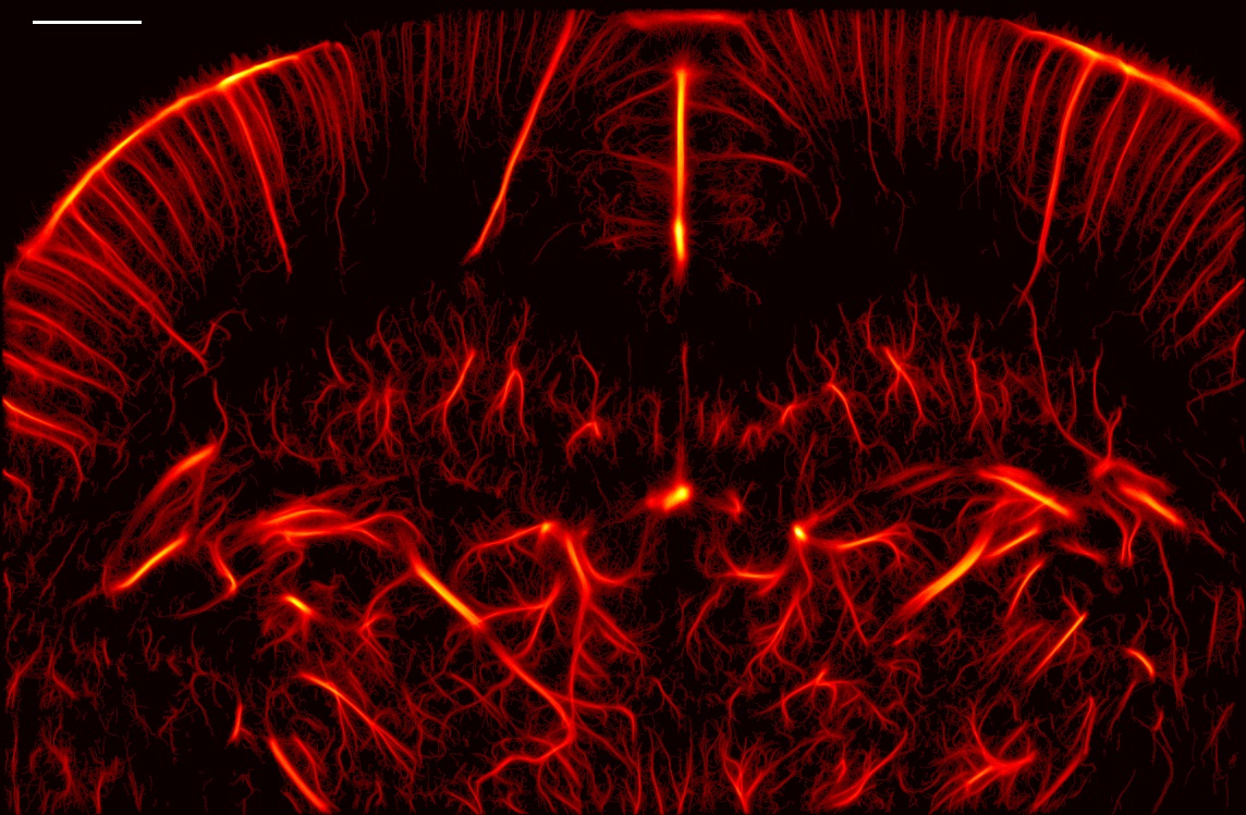 Performance benchmarking of microbubble-localization algorithms for ultrasound localization microscopy