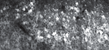 Seeing single action potentials in the brain
