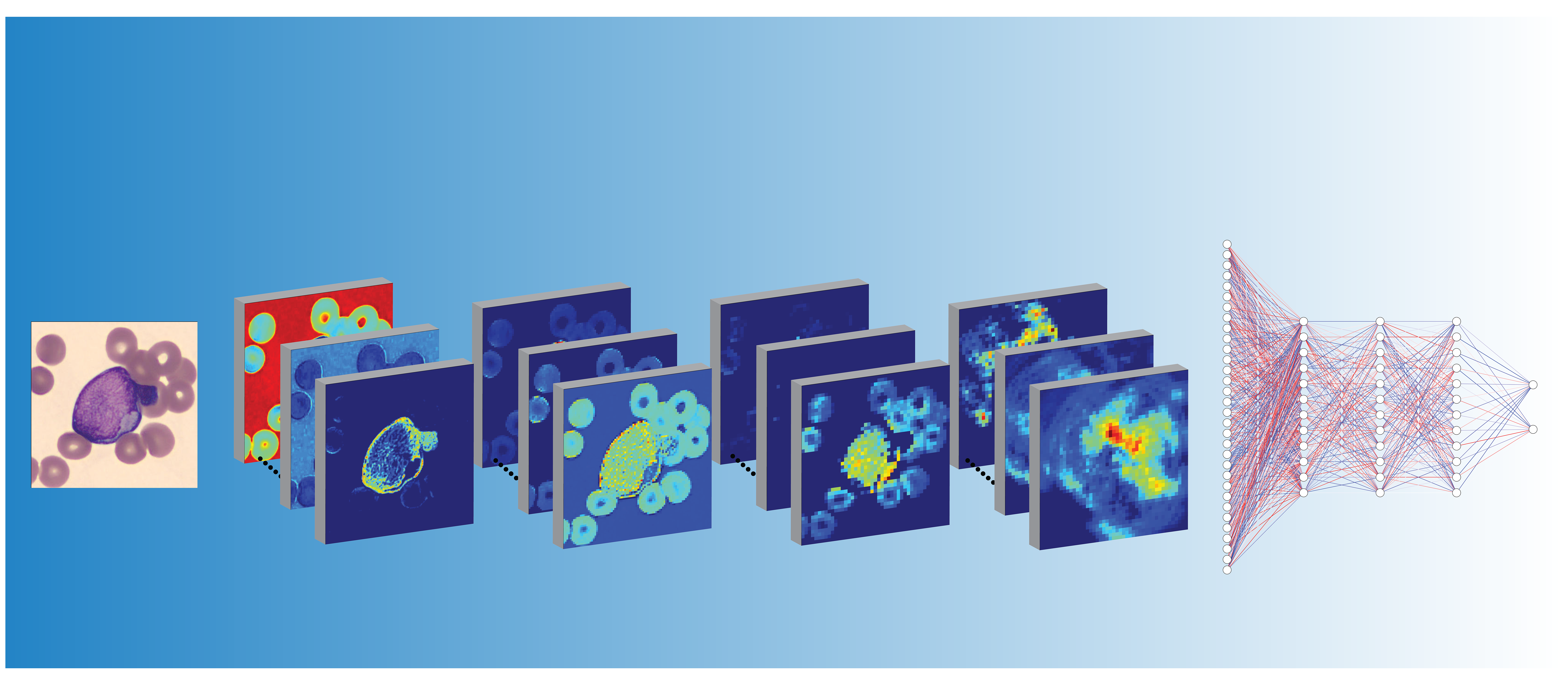 Deep learning for diagnosis of Acute Promyelocytic Leukemia via recognition of genomically imprinted morphologic features
