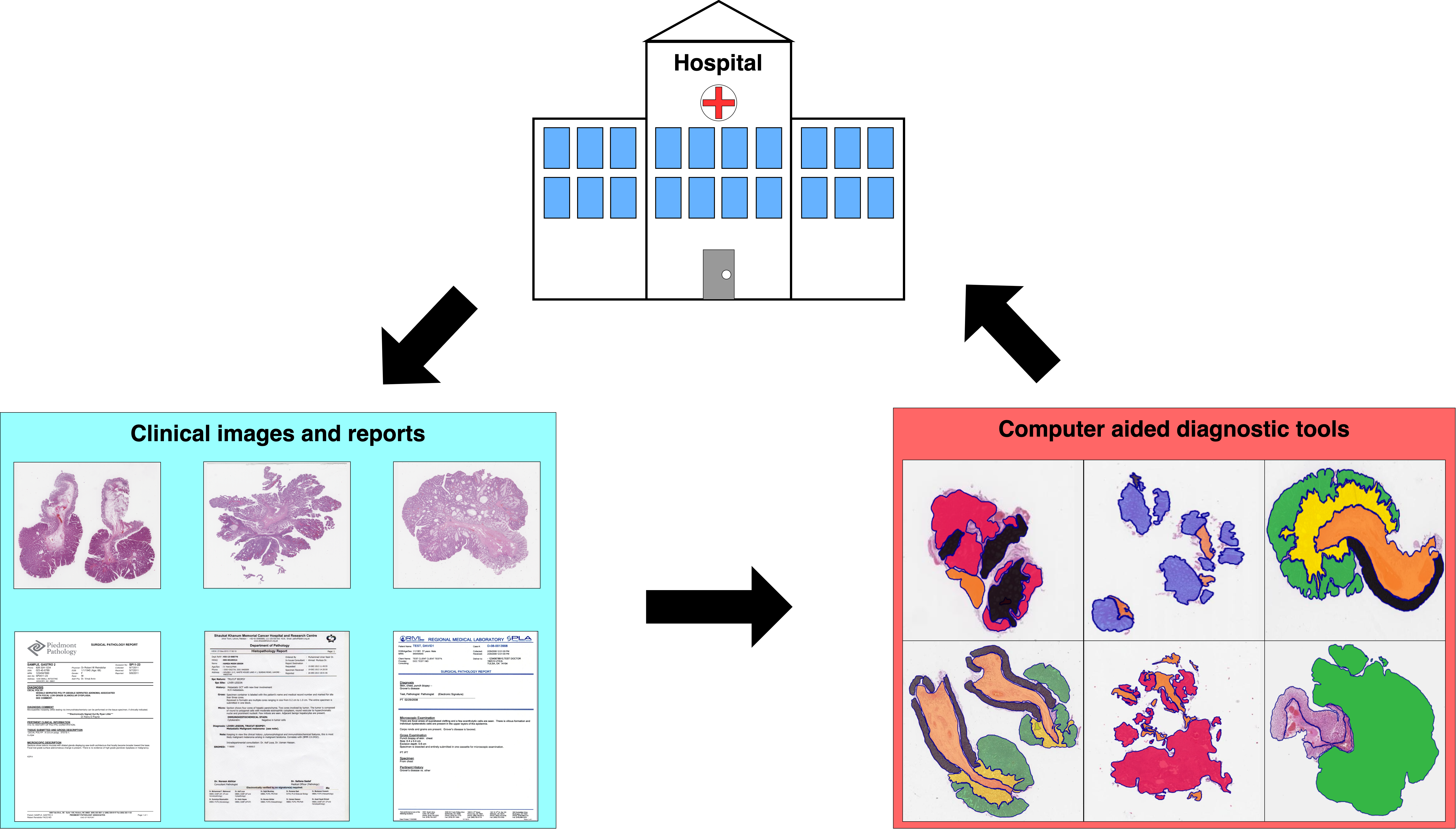Unleashing the potential of digital pathology data by training computer-aided diagnosis models without human annotations