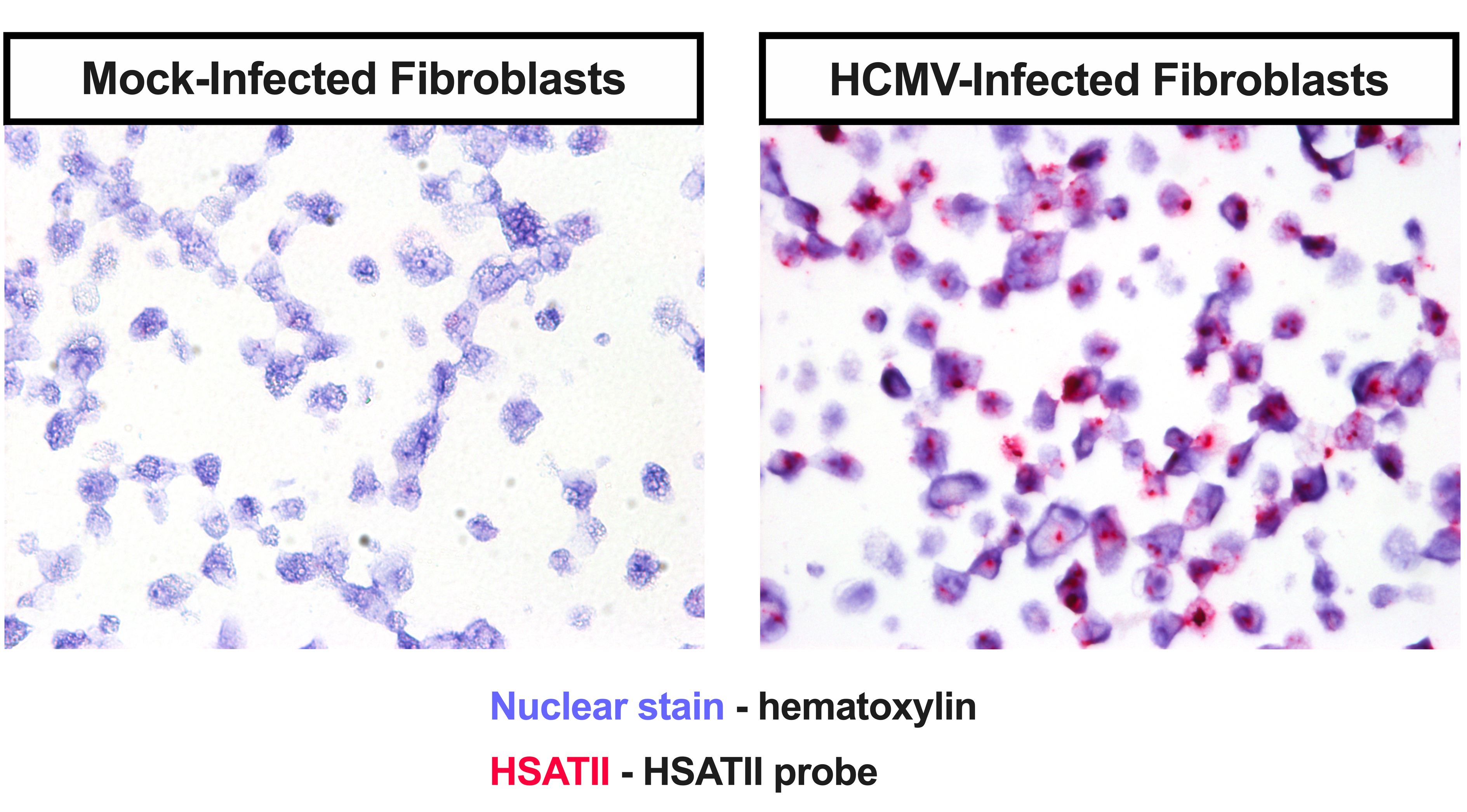 A tumor-specific endogenous repetitive element is induced by herpesviruses