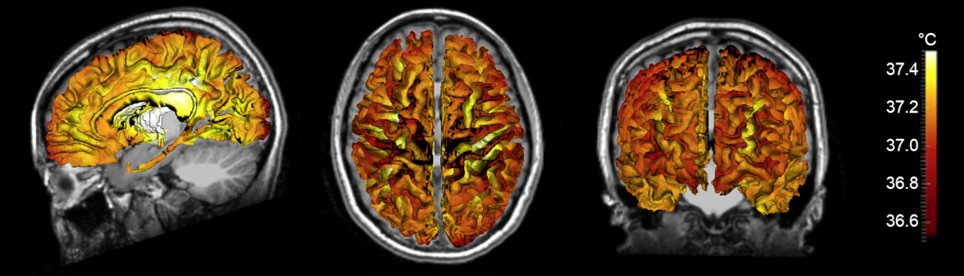 Predicting Human Brain Temperature
