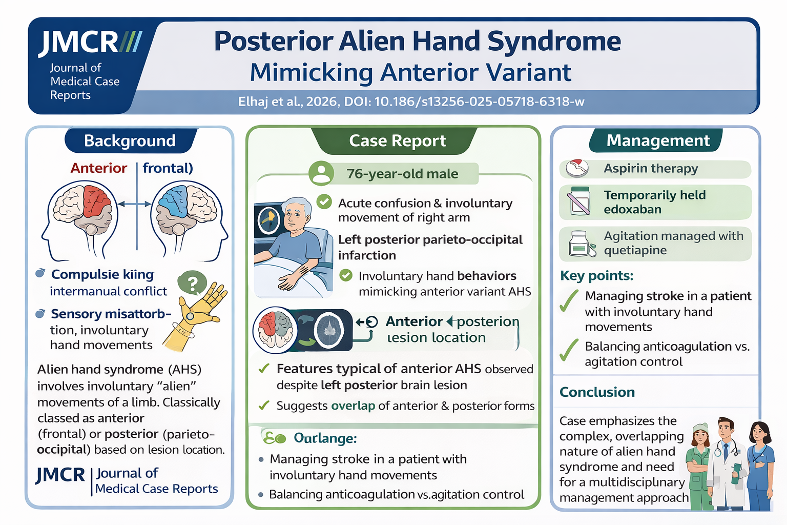 When One Hand Acts on Its Own: A Stroke Presentation with Mixed Alien Hand Features
