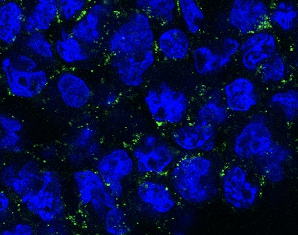 Turning leukemia cell death into an immune alarm