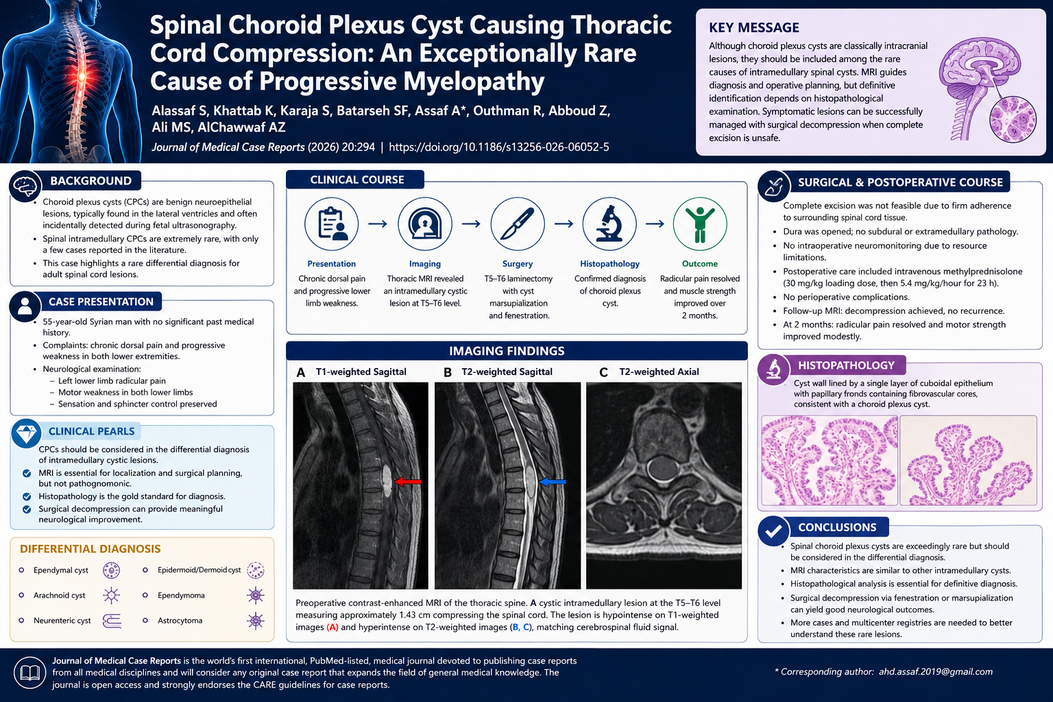 Spinal Choroid Plexus Cyst Causing Thoracic Cord Compression: An Exceptionally Rare Cause of Progressive Myelopathy