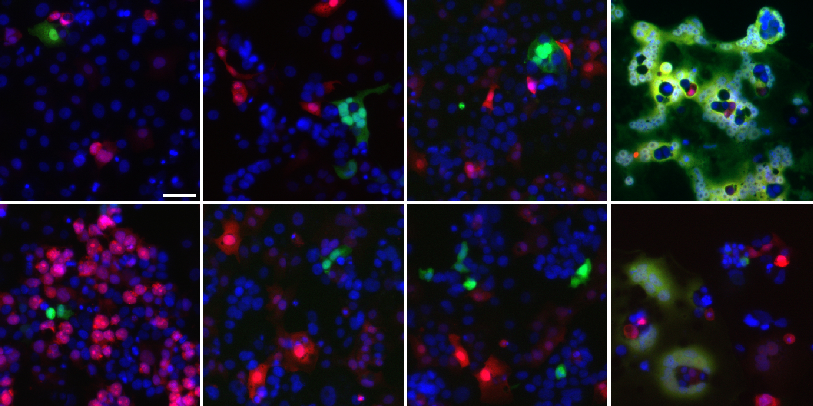 Our built-in protection from coronavirus infection