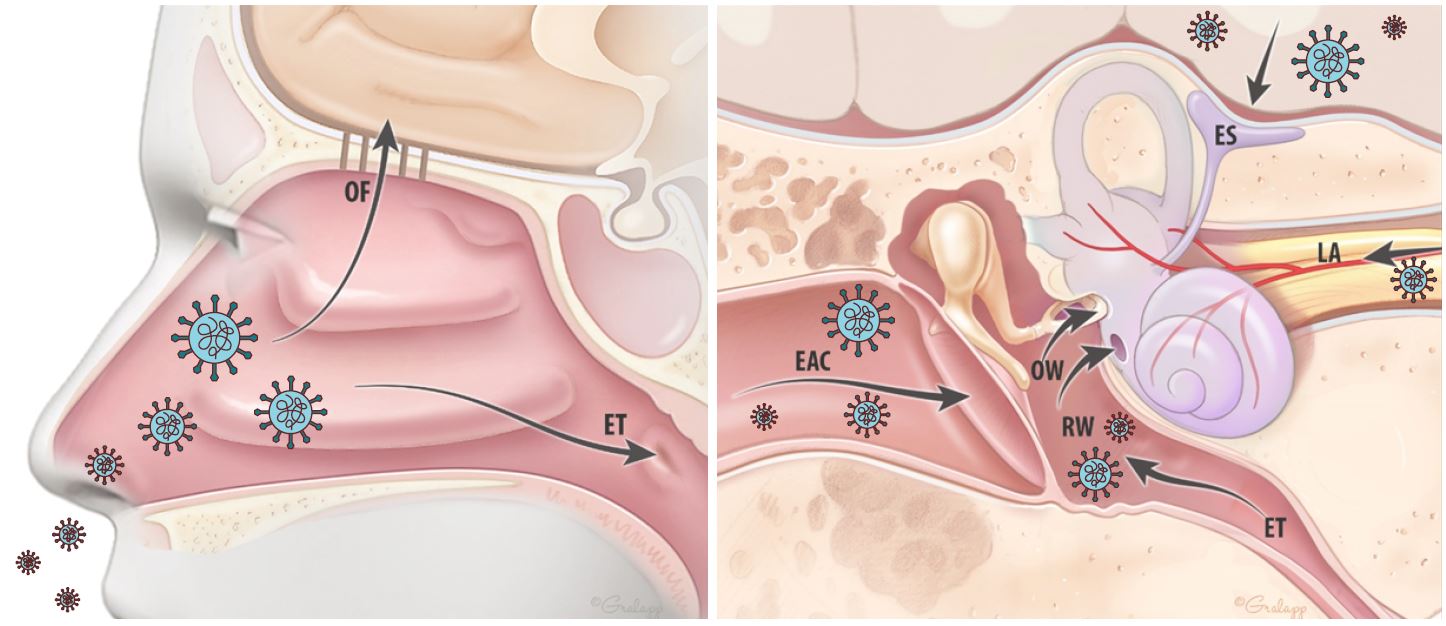 A link between COVID-19 and Symptoms of Hearing loss, Tinnitus, and Vertigo