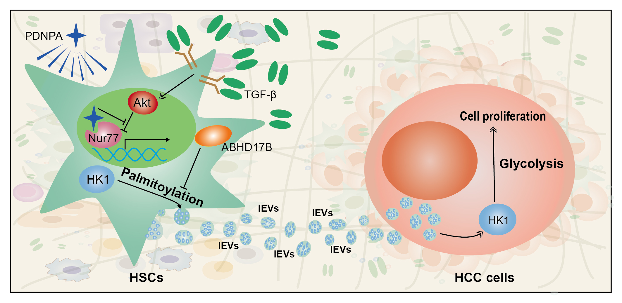 HK1 from HSC-derived extracellular vesicles expedites HCC progression