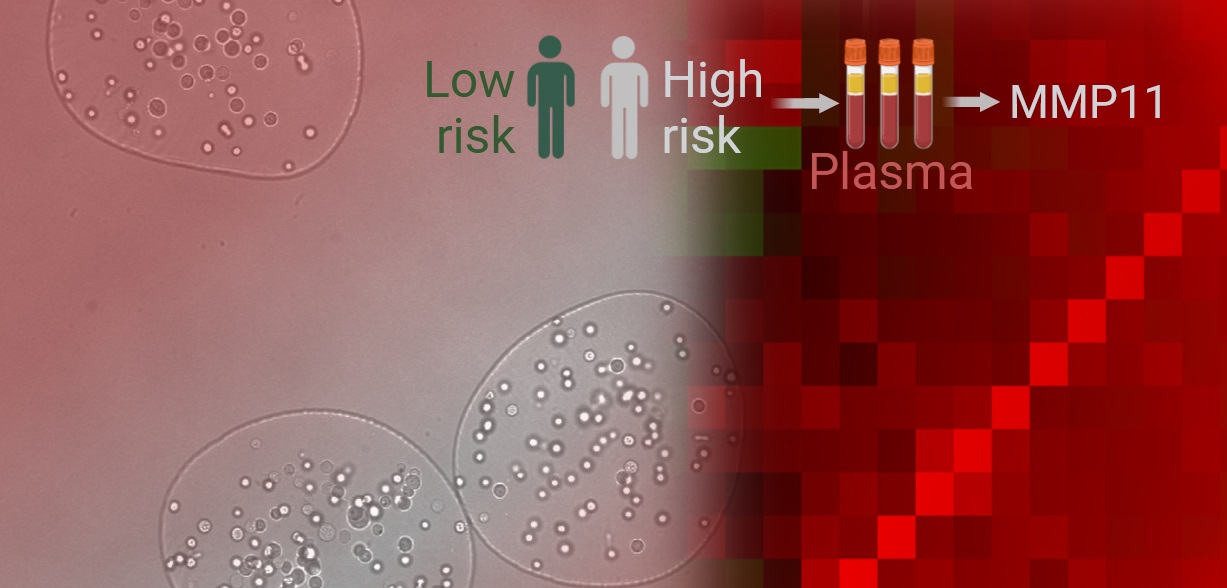 Advancing prostate cancer research with blood-based biomarkers