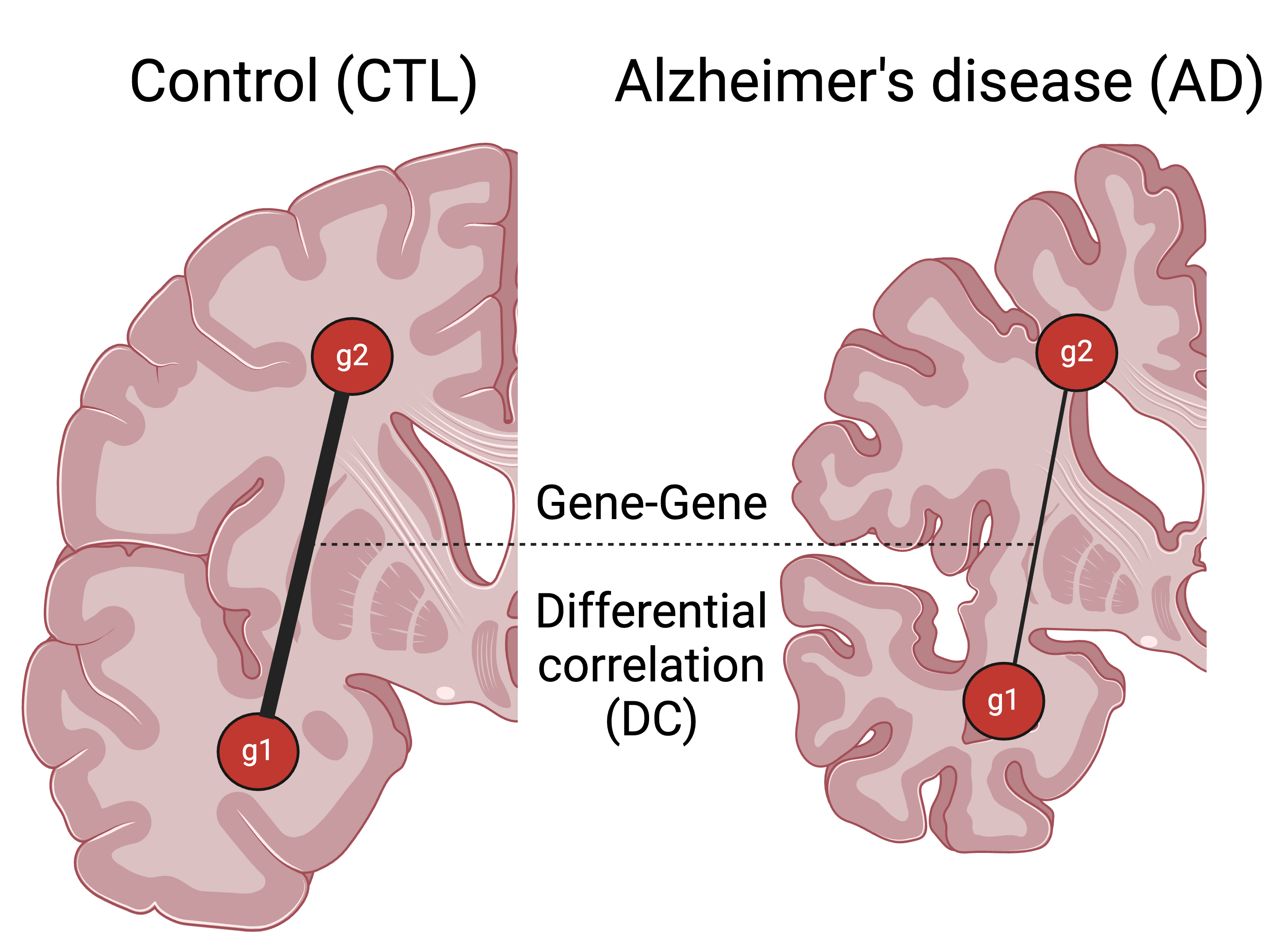 InterTissueDC: Exploring gene-gene coupling across brain regions in Alzheimer’s disease