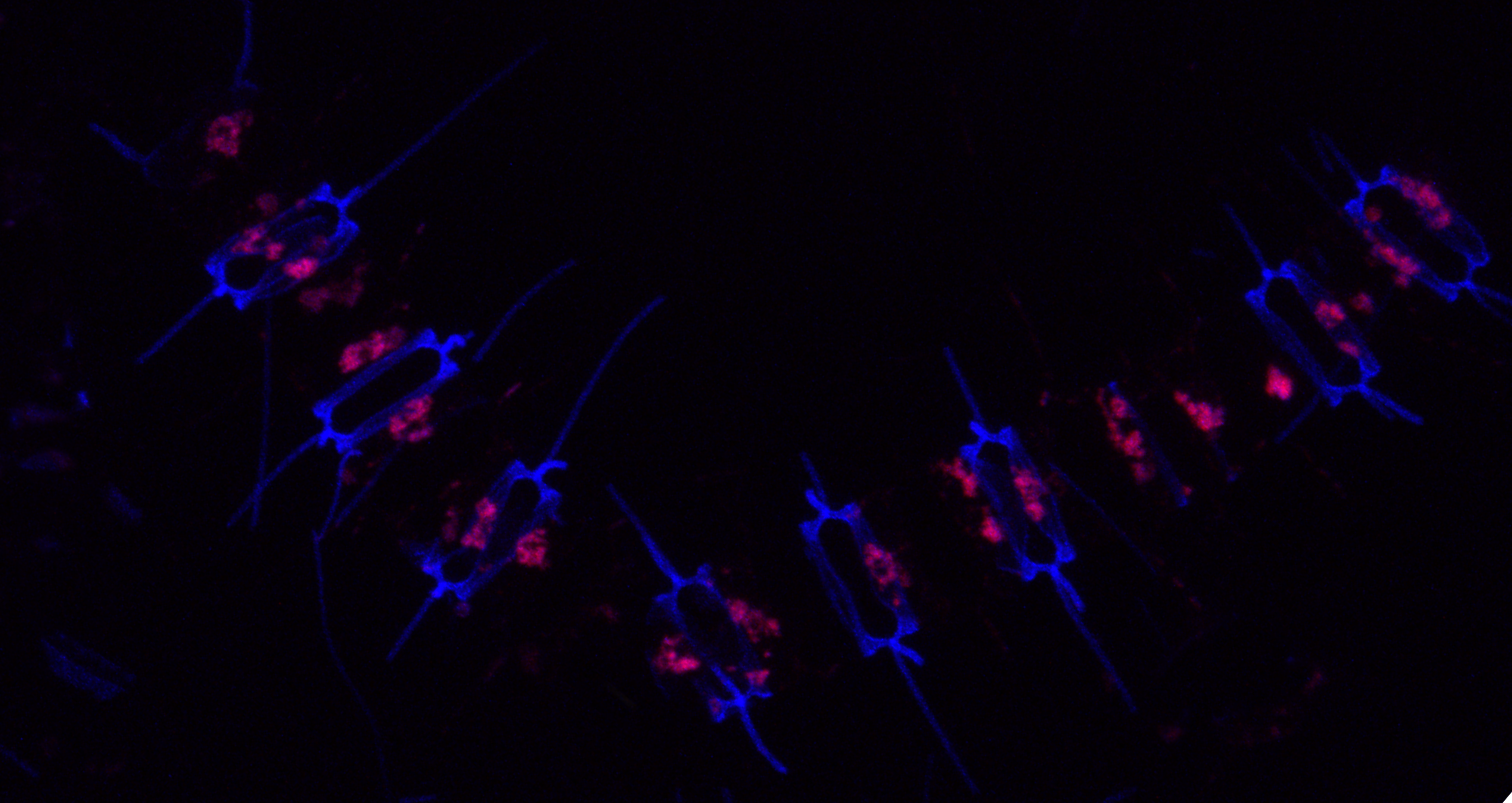 When diatoms get sick
