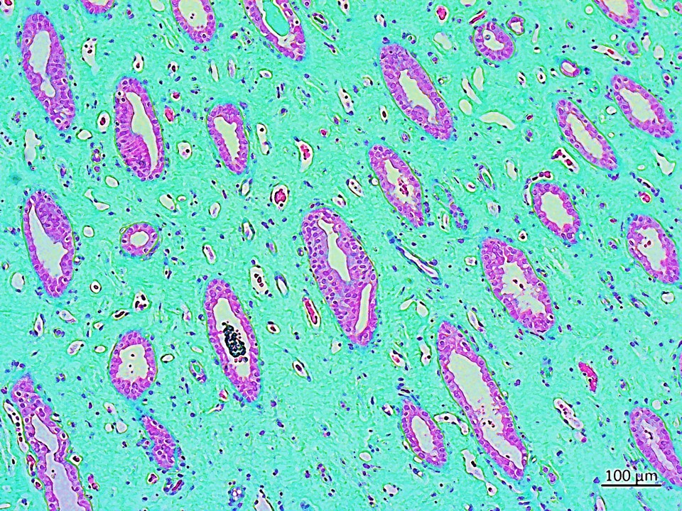 Experimental biology – Bioinspired engineering on a kidney chip to investigate renal calcification