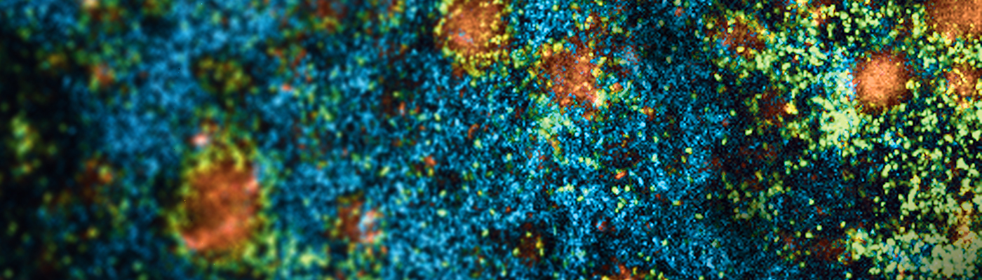 Happy Birthday npj Biofilms and Microbiomes!