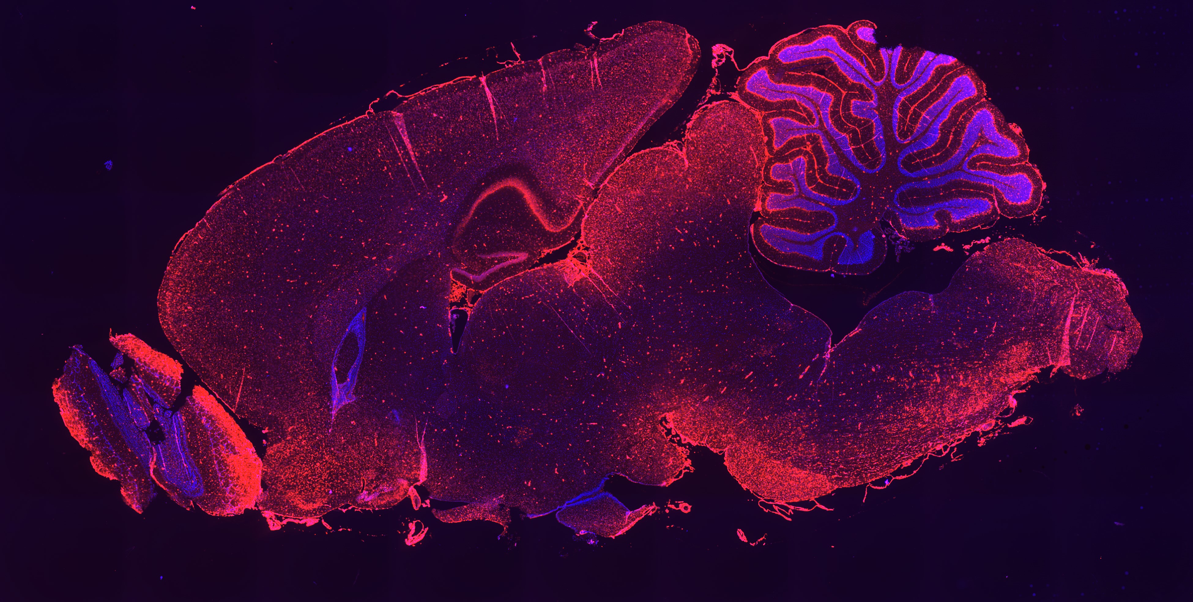Expanding the Reach of RNAi Therapeutics with Next Generation Lipophilic siRNA Conjugates