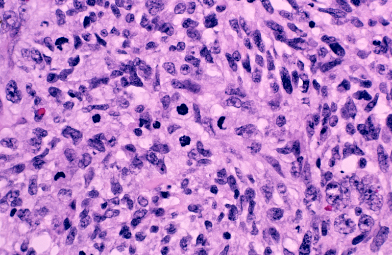 AACR II sneak-peek