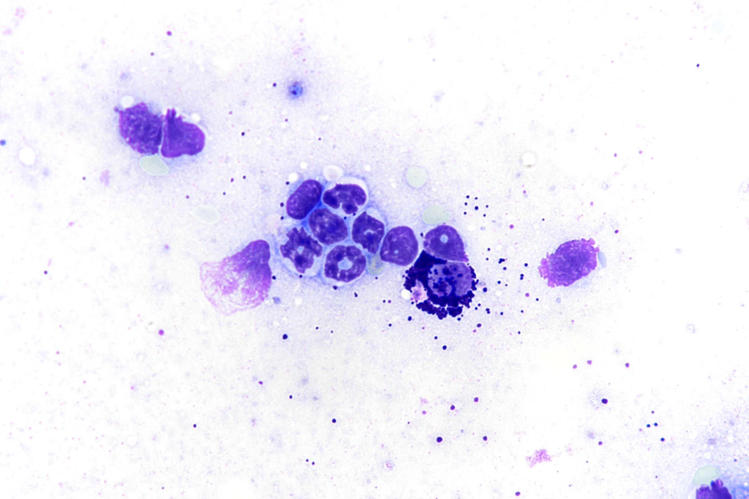 Advancing systemic mastocytosis research through a novel pre-clinical model