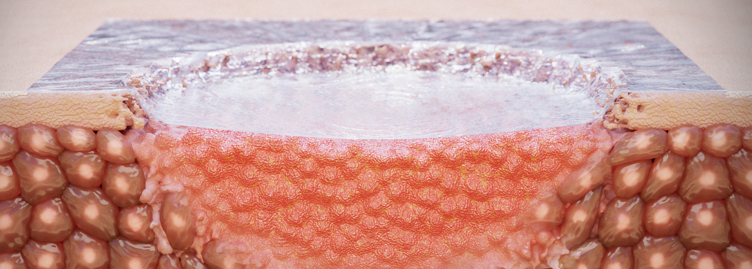 Strain-Programmed Patch for Diabetic Wound Healing