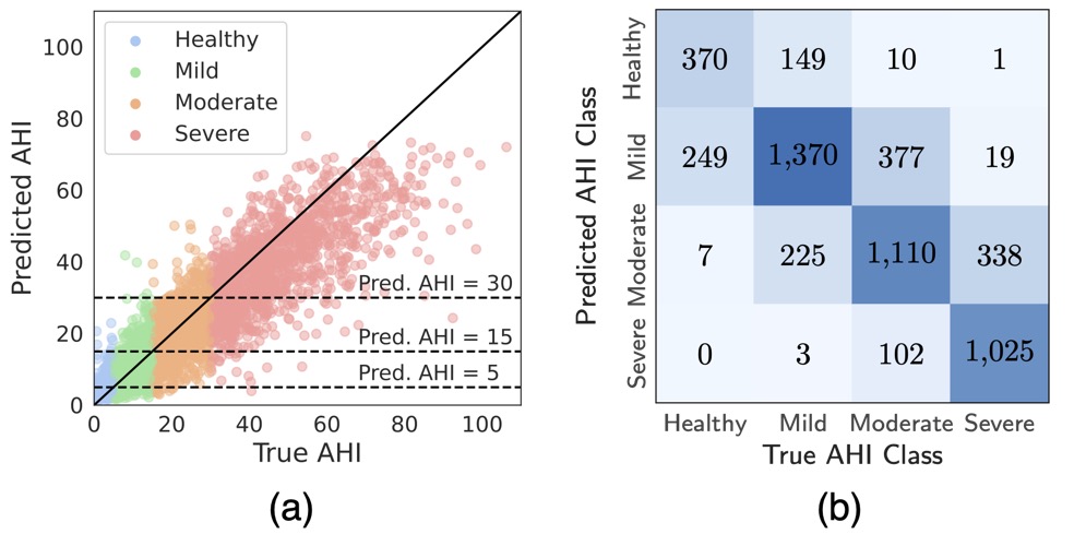 Towards Automatic Home-Based Sleep Apnea Estimation Using Deep Learning