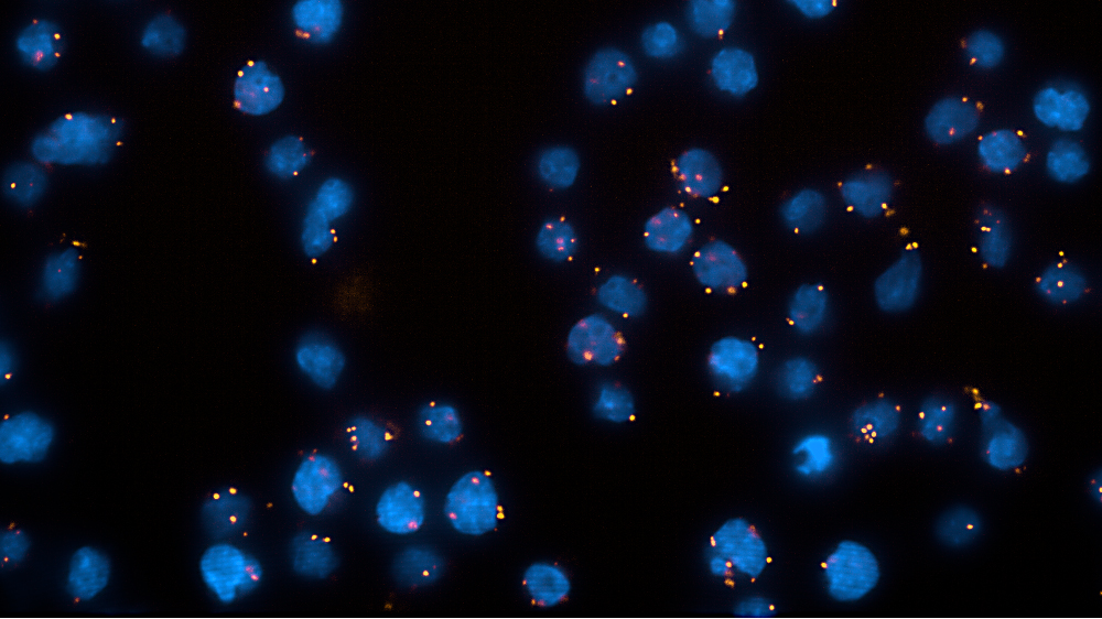 Protein activation assays are a better ALL-stratification tool than mutation profiles ?
