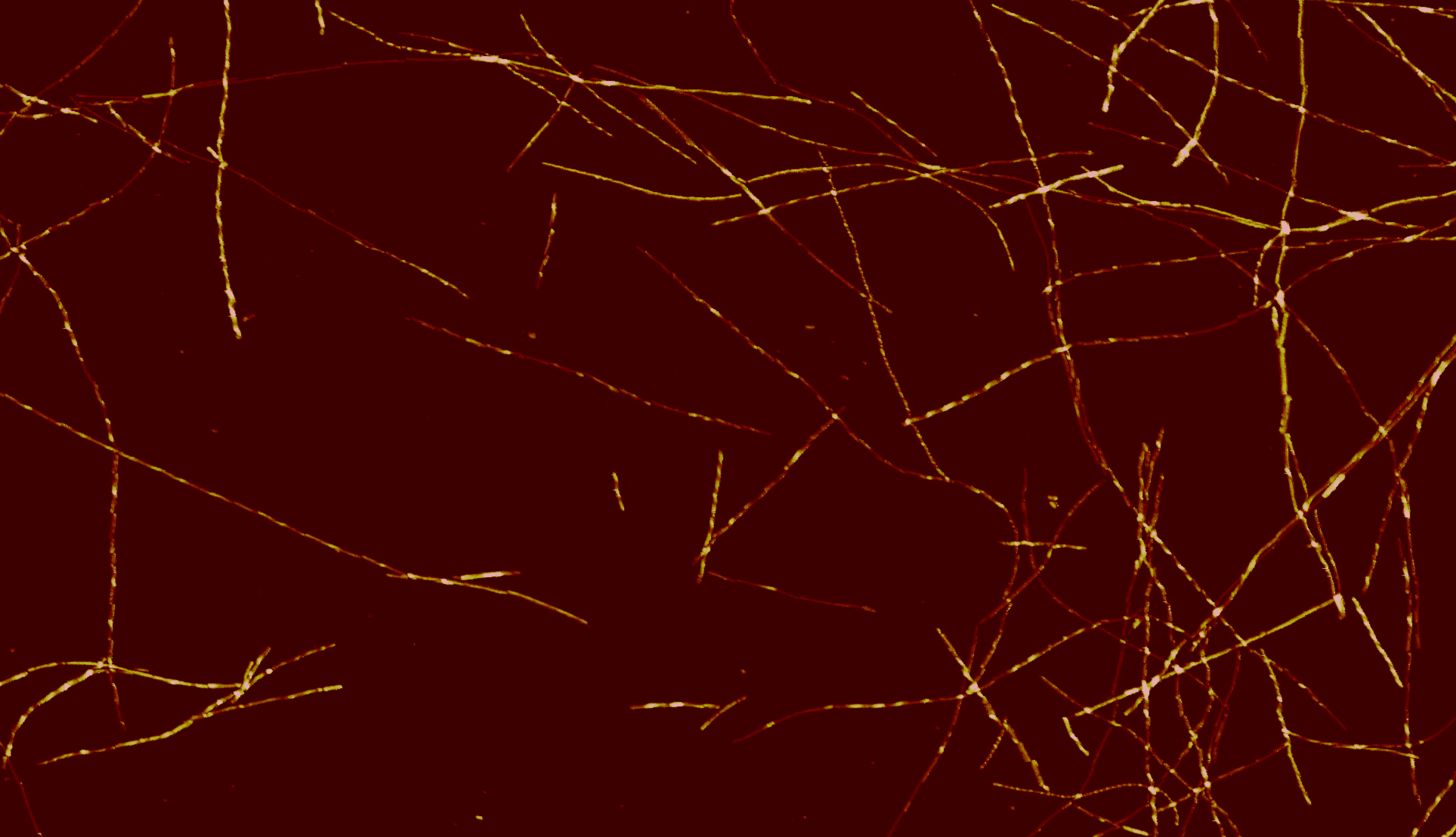 AFM reconstruction of Aβ42 fibril populations assembled in vitro reveals rare species that resemble amyloid polymorphs from human brains