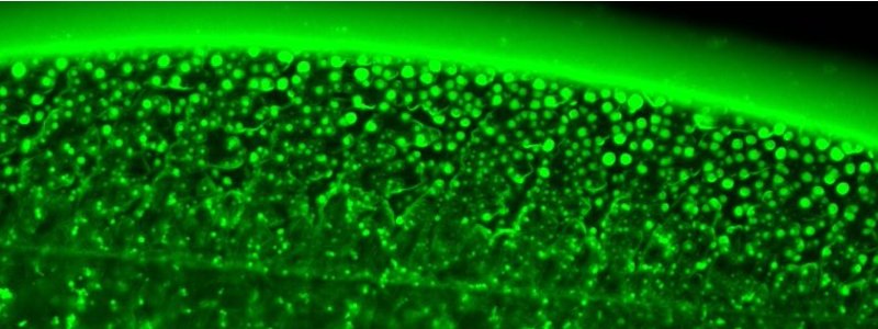 How ticks stick: on the phase separation and ageing of glycine-rich protein from tick adhesive