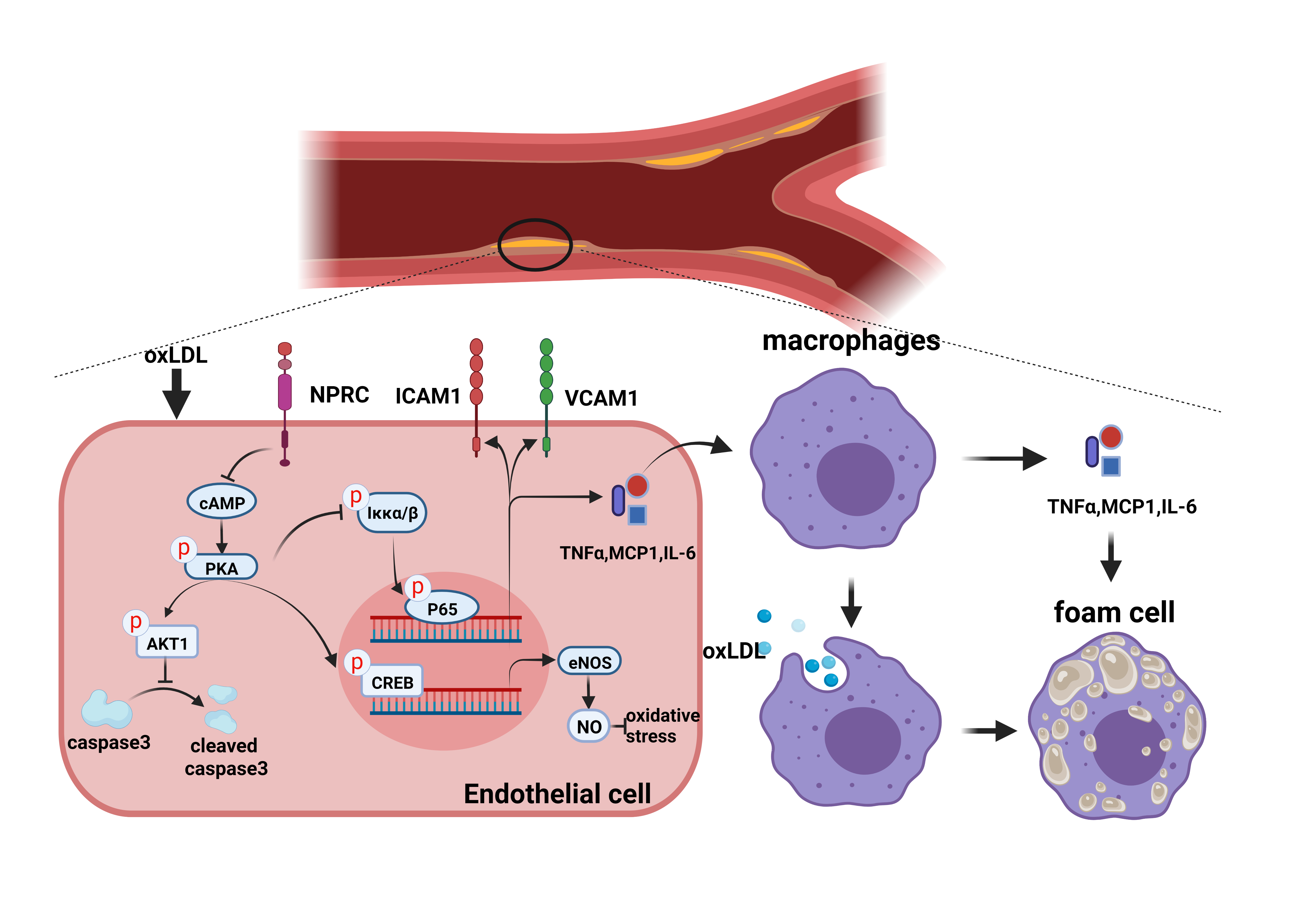 NPRC deletion mitigated atherosclerosis by inhibiting oxidative stress, inflammation and apoptosis in ApoE knockout mice