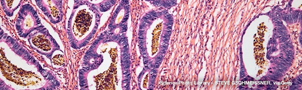 Collection: Colorectal Cancer Awareness Month