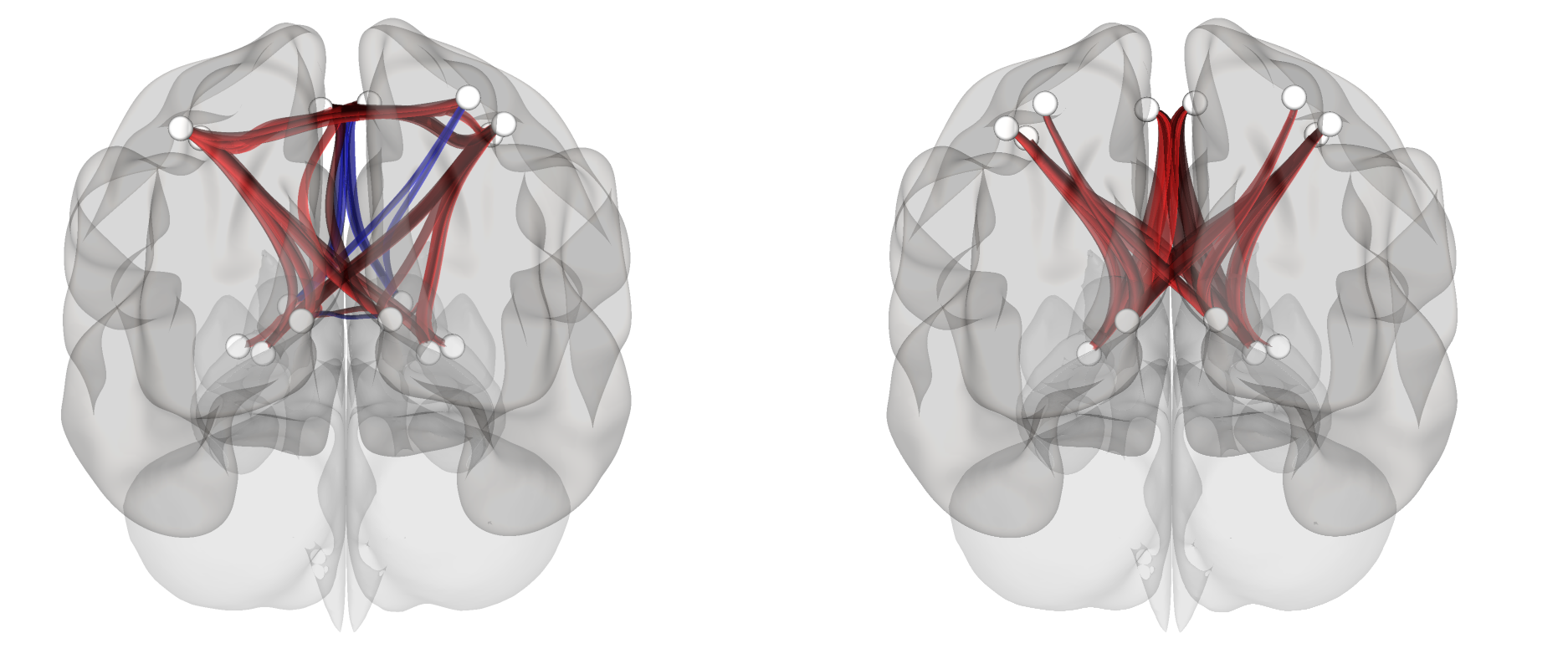 The neural signature of psychomotor disturbance in depression