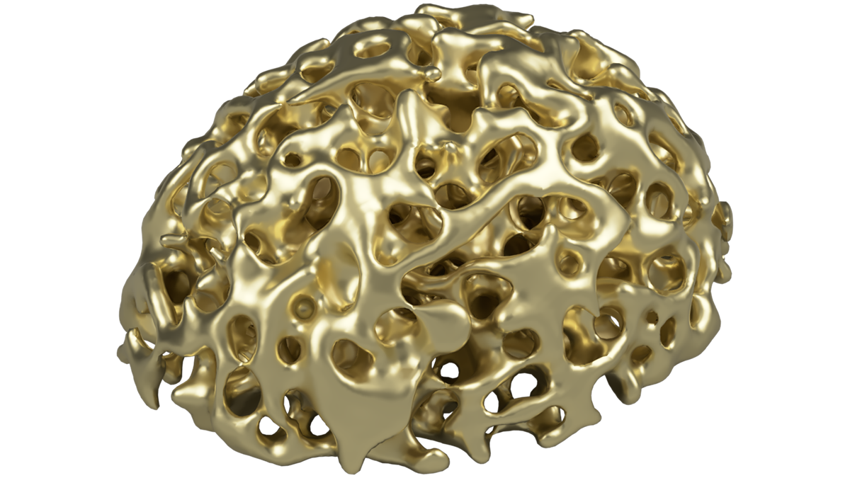 Structure and Design of Gold Nanosponges