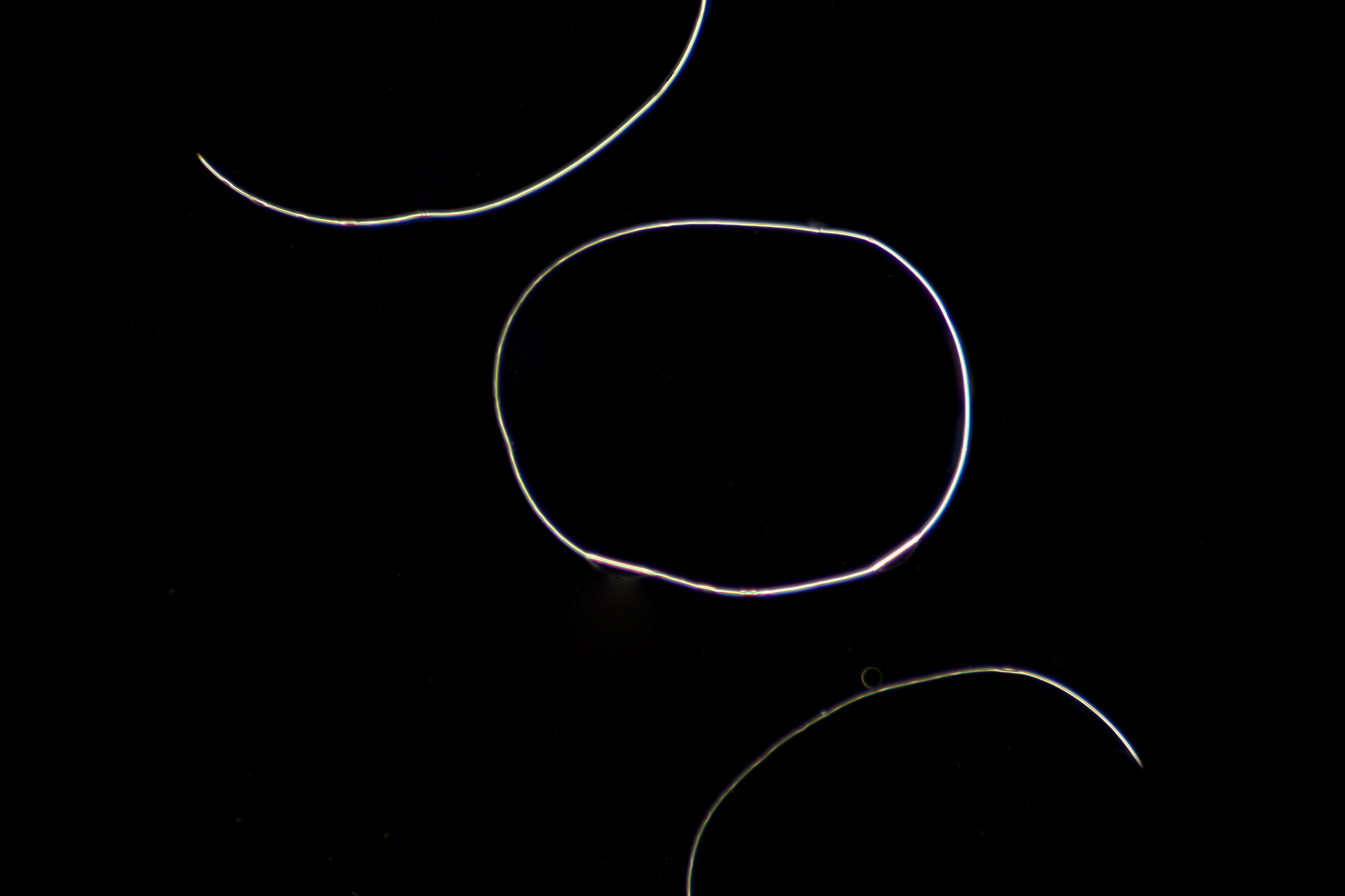 Journal Club: The physics behind those bacterial grenades on your agar plate