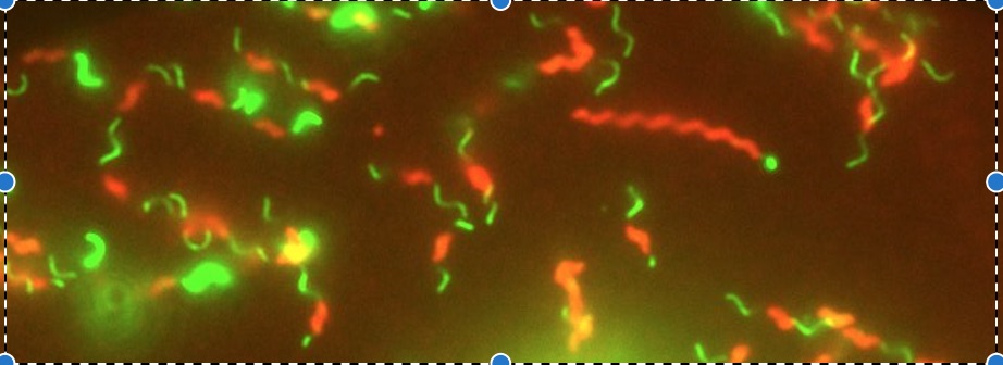 Secrets of Campylobacter jejuni's swimming style revealed by high-speed video 