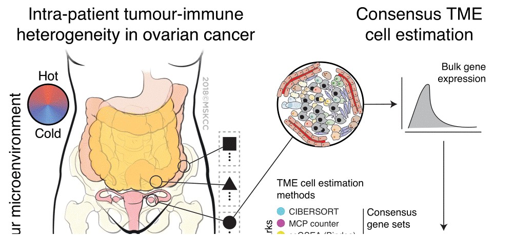 Unraveling tumor-immune heterogeneity in advanced ovarian cancer uncovers immunogenic effect of chemotherapy