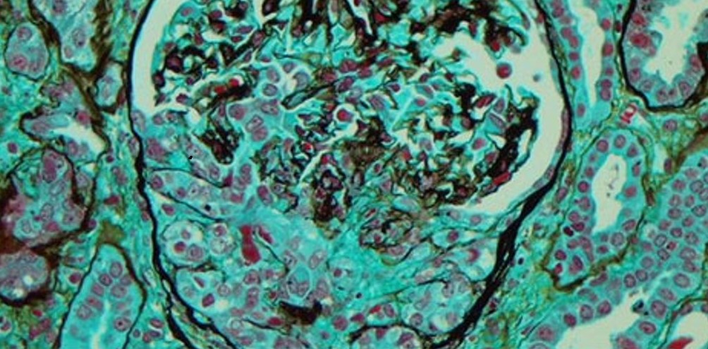 Plasmid-derived sequences as molecular mimics in autoimmune disease