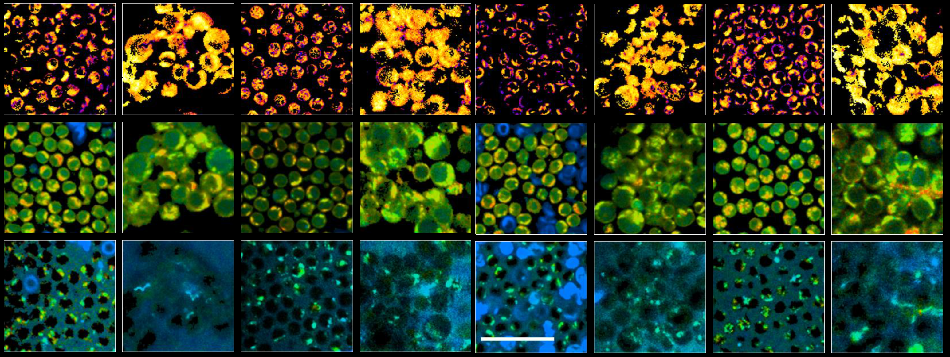 Label-free Imaging of T cell Activation