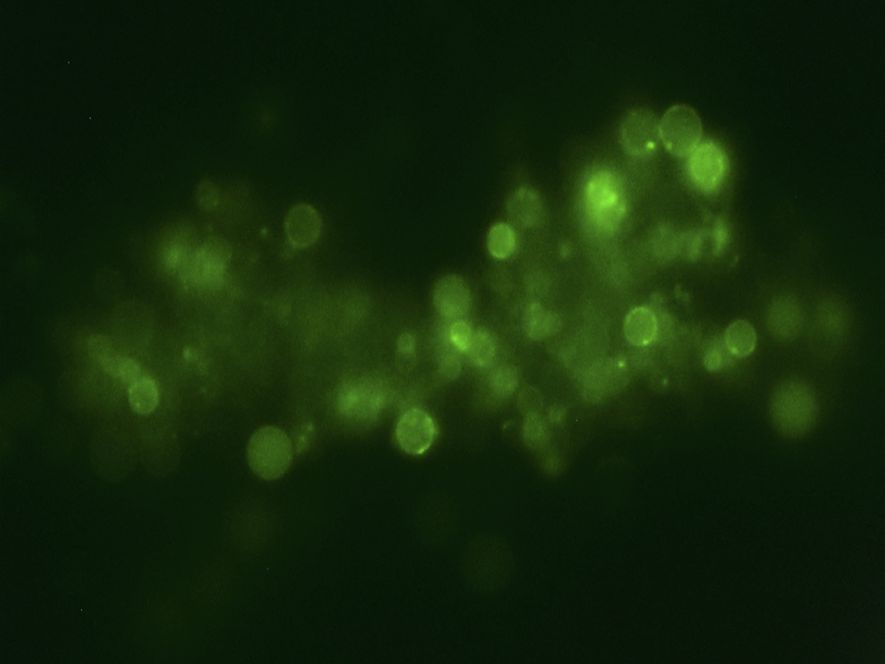 Stress-induced cell wall-deficiency