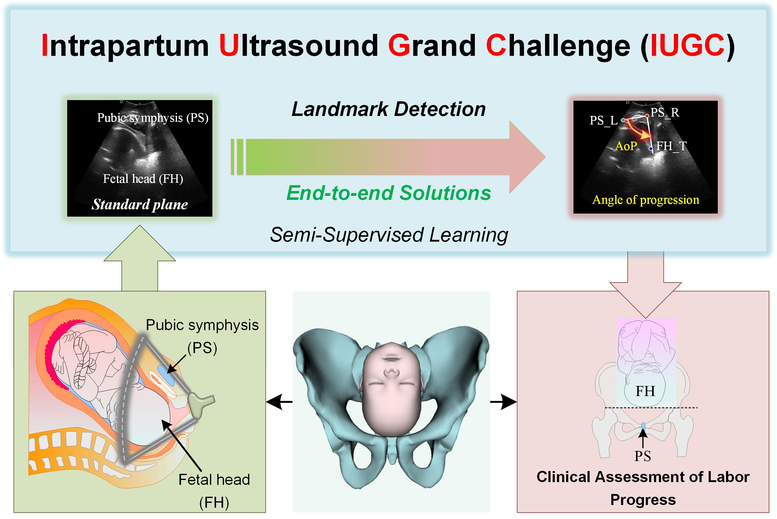 Jieyun Bai's Challenge Paper "IUGC: A Benchmark of Landmark Detection in End-to-End Intrapartum Ultrasound Biometry"
