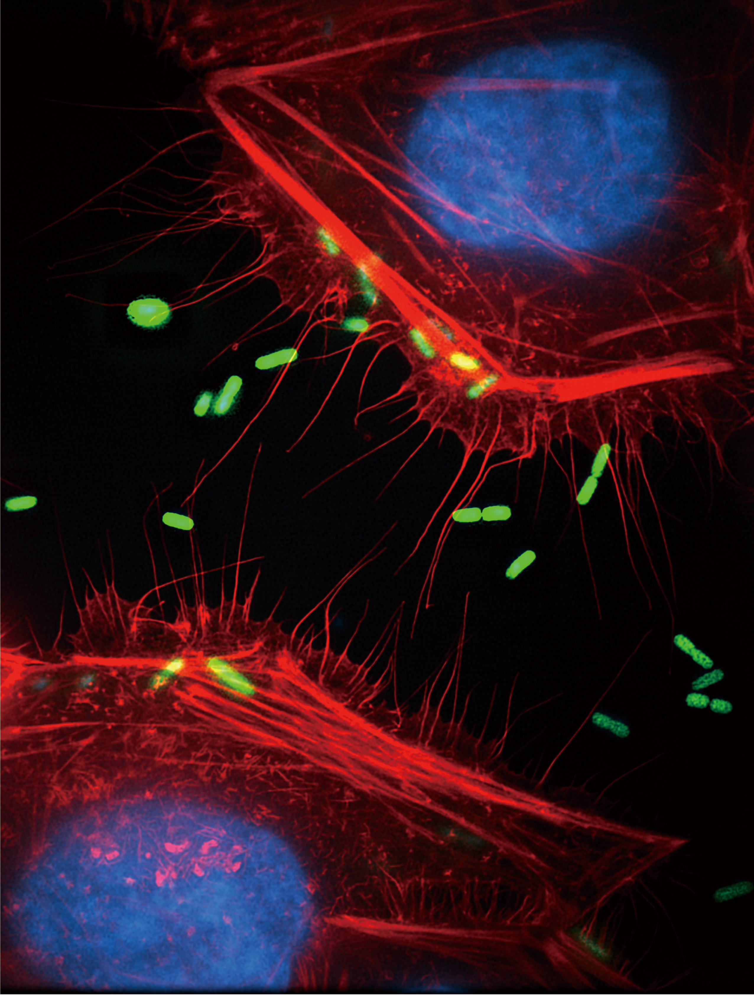 Unveiling the Intricate Mechanism of HD5-Mediated Shigella Invasion: A Scientific Odyssey