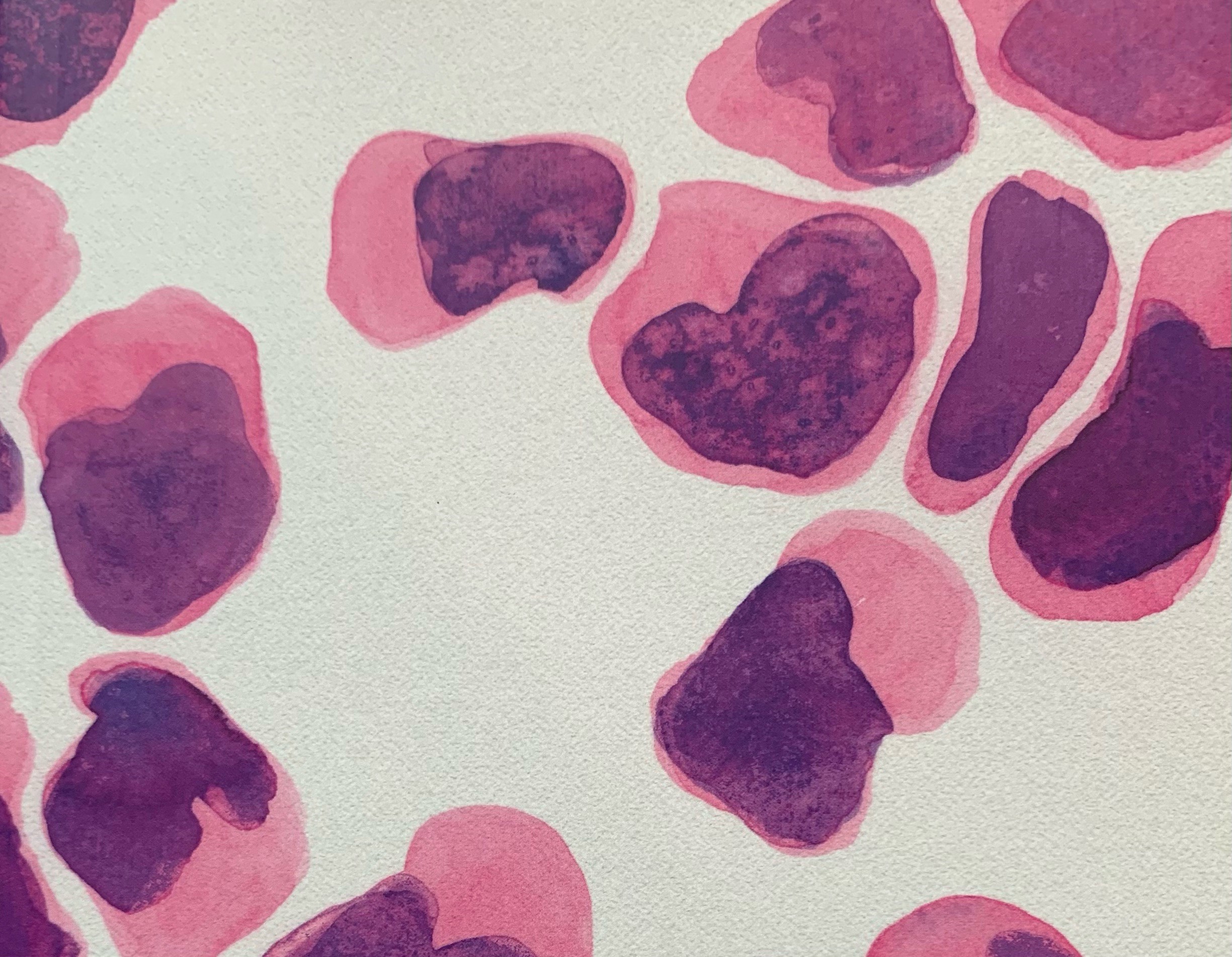 Natural Killer - the memoir of a unique cancer patient