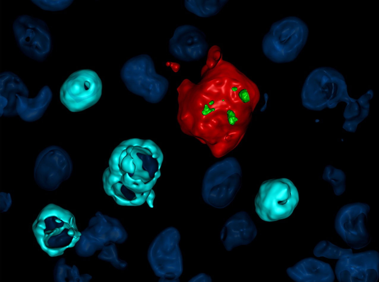 HIV reservoir in tissue macrophages: from myth to reality