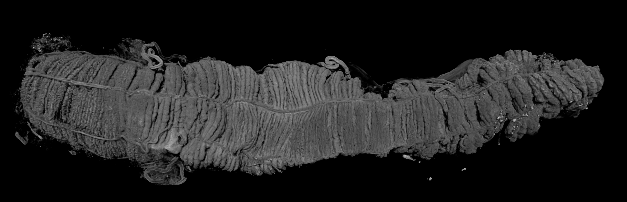 Caterpillars as Alternative Animal Models for Inflammatory Bowel Disease